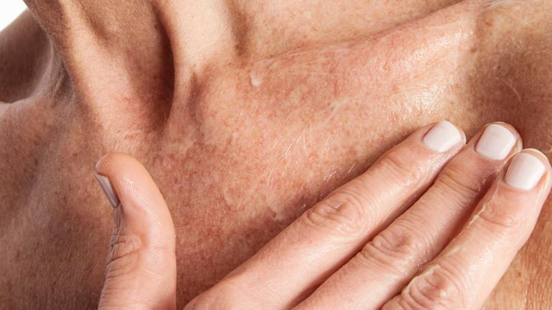 Are You Neglecting Your Neck?