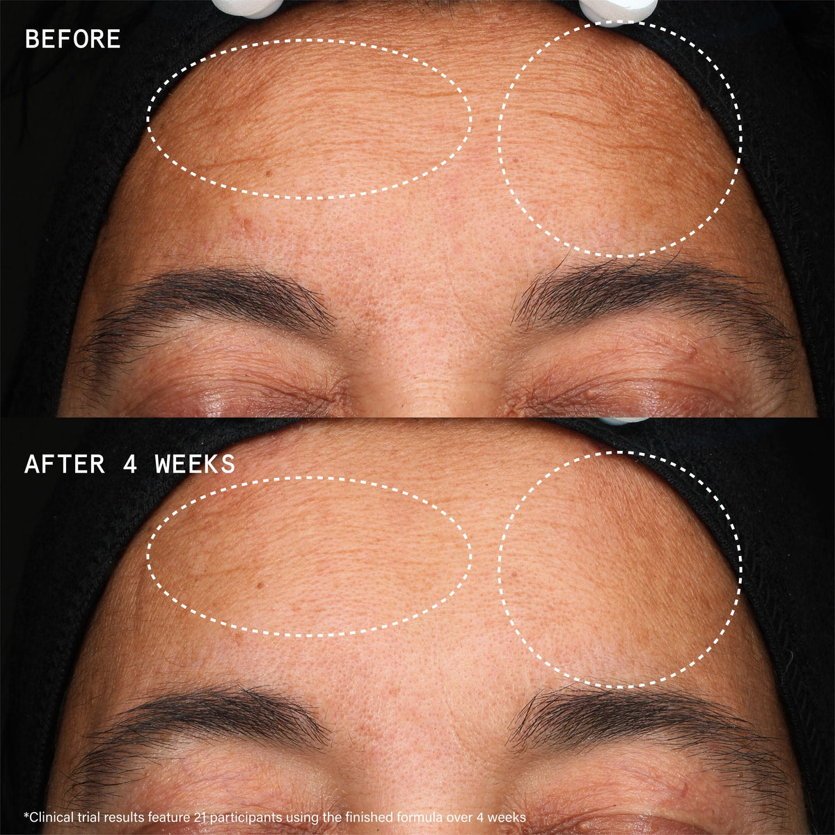 Youthbomb Extreme Retinal Triple Renewal Serum - 5% Power Complex of Retinoid + Retinal + Bio-Bakuchiol