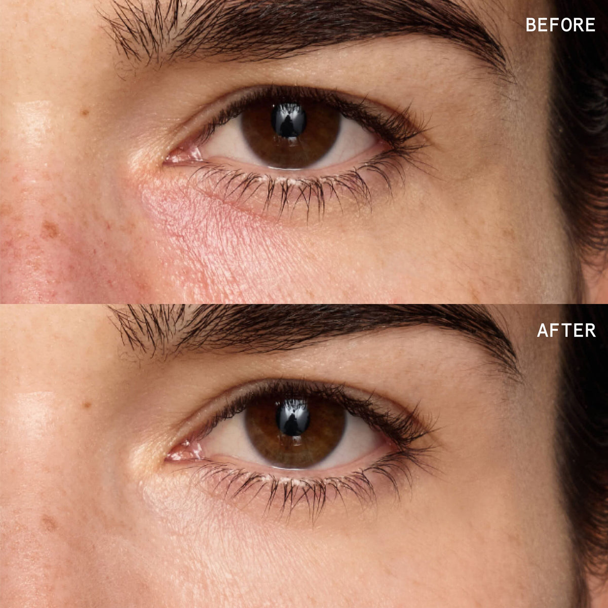 Superluminous Under-Eye Genius