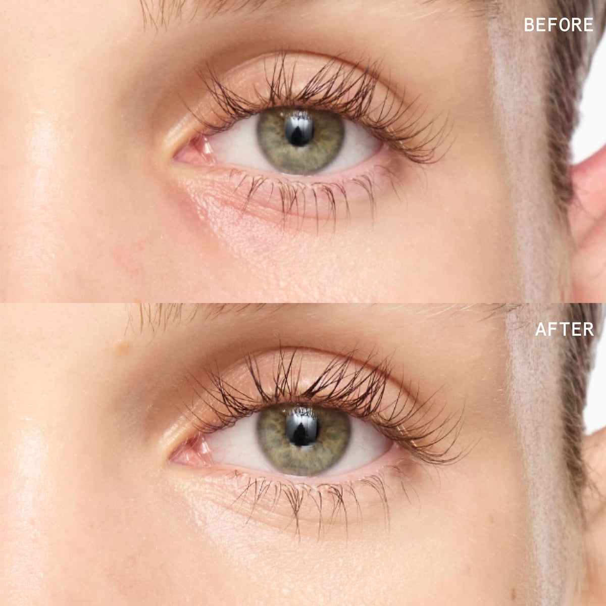 Superluminous Under-Eye Genius